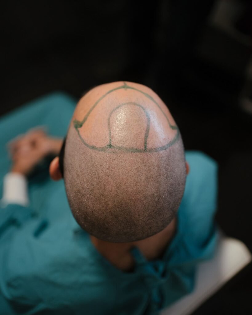 Micro Hair