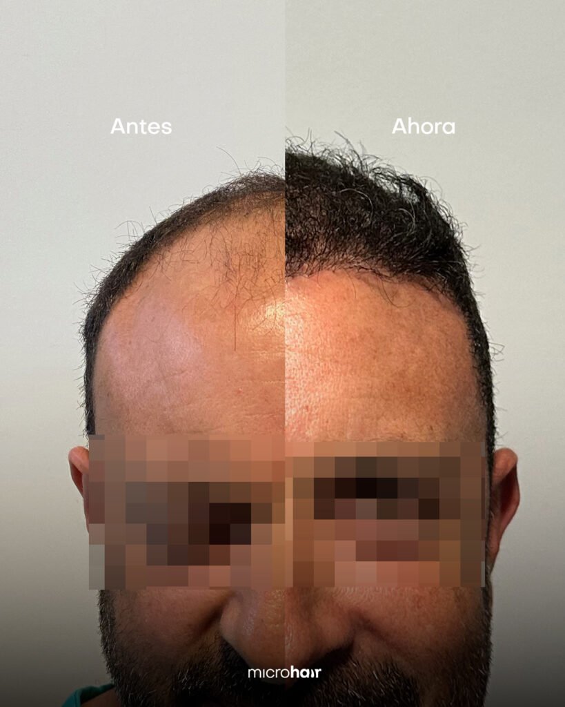 Casos de éxito