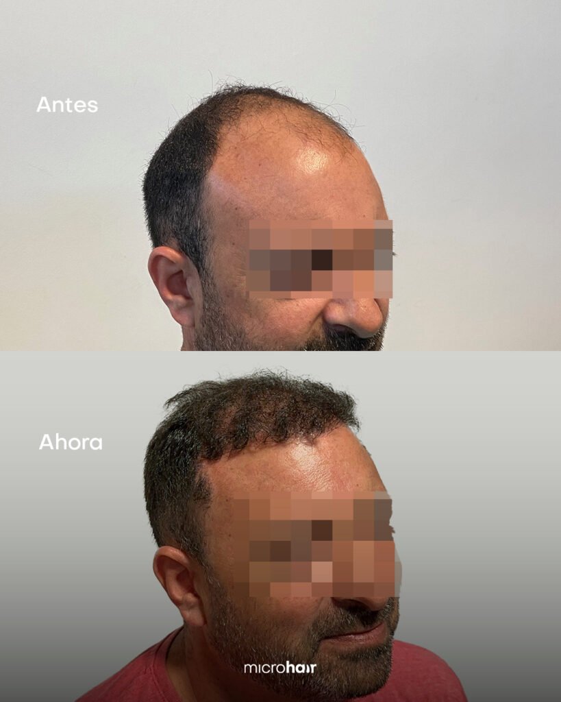 Casos de éxito