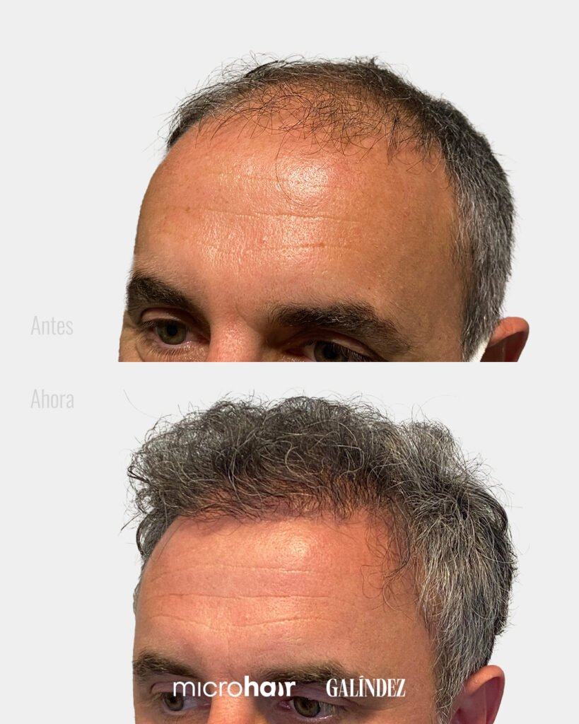 Casos de éxito